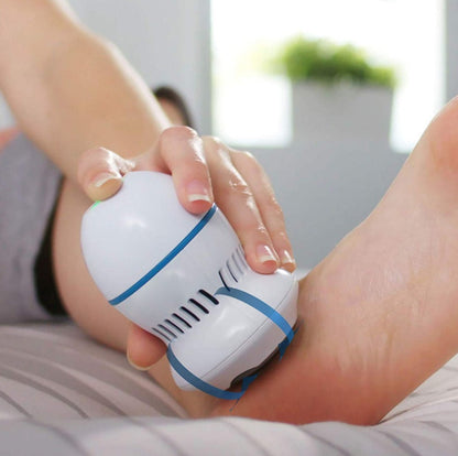 SmoothStep™ – Electric Foot Callus Remover