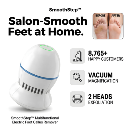 SmoothStep™ – Electric Foot Callus Remover