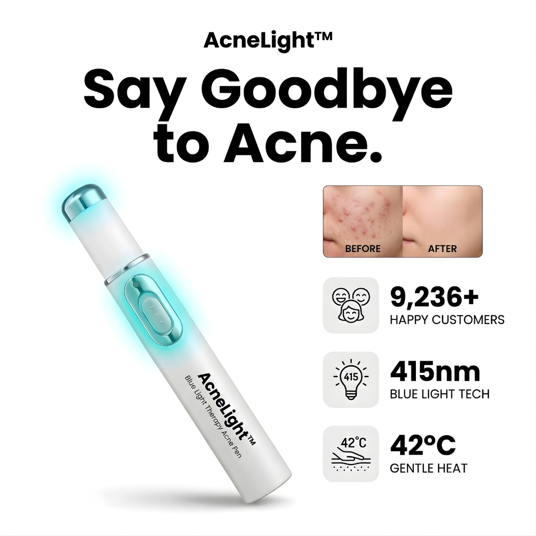 AcneLight™ – Blue Light Therapy Acne Pen