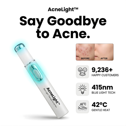 AcneLight™ – Blue Light Therapy Acne Pen